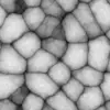 Infected Skin (6248) - Image 6